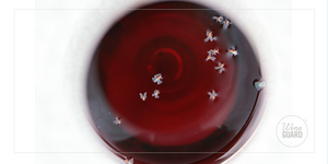 How Do I Keep Fruit Flies Out of My Wine?